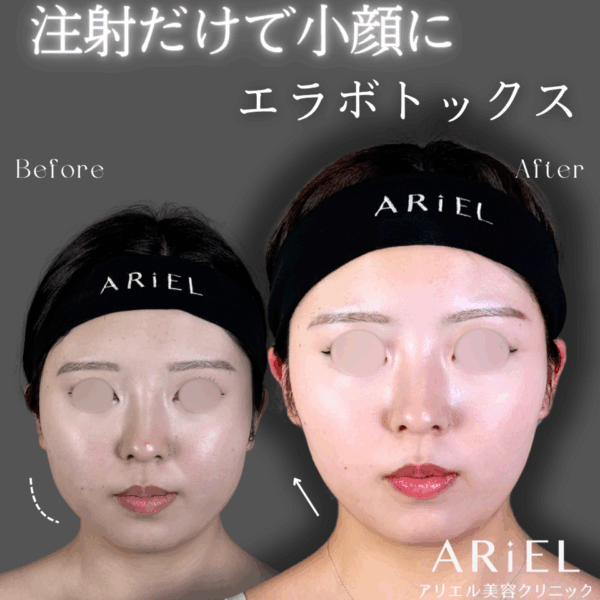 No.9160の症例写真